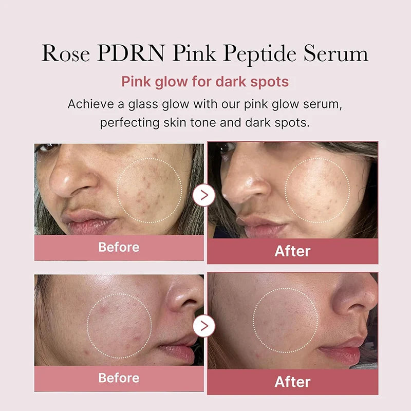 PIBU Peptide Glow Serum benefits for radiance, elasticity and deep hydration
